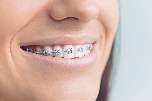 Best Invisalign and Clear Aligners  in Snow Hill, MD